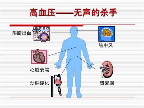 如何探索《生命奇境》中神秘的高血压生物